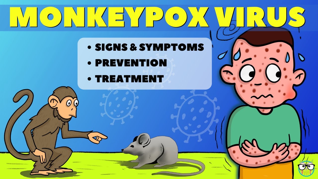 Basic Things You Need To Know About Monkeypox – Health Topics by DP